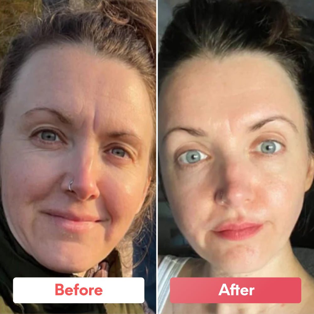 Sheallures™  Glass Skin Collagen Mask