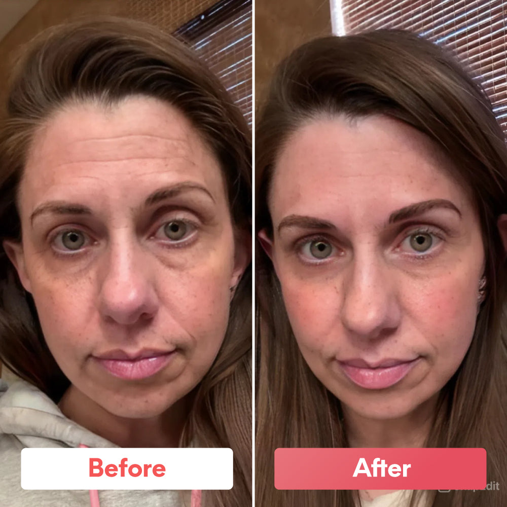 Sheallures™  Glass Skin Collagen Mask